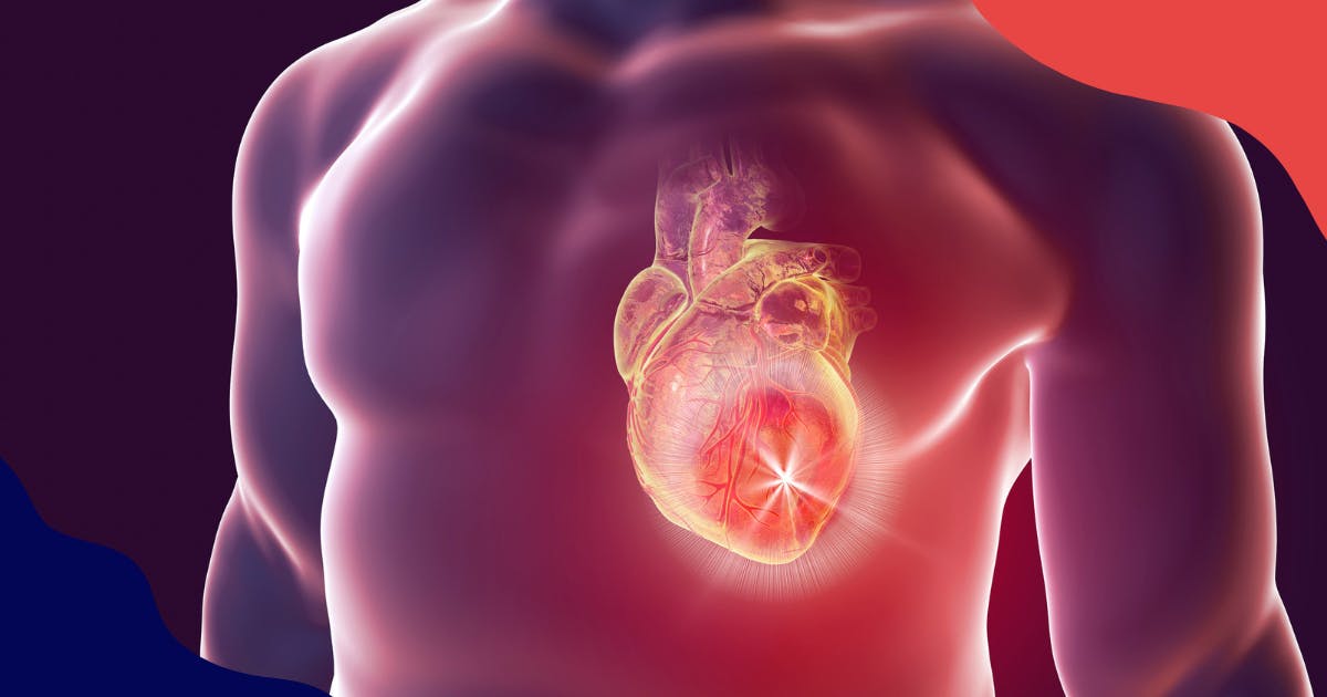 Cardiovascular Diseases